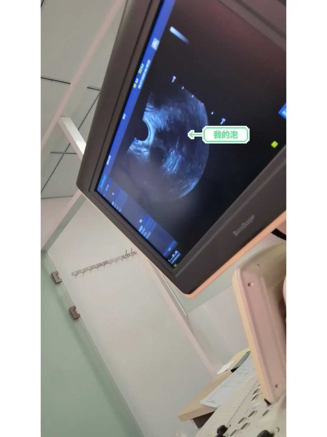 基因筛查与供卵结合的双重保障方案解析